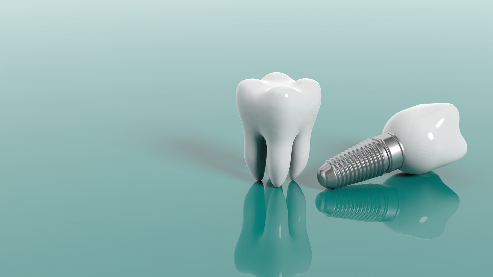 Dental implants Kent