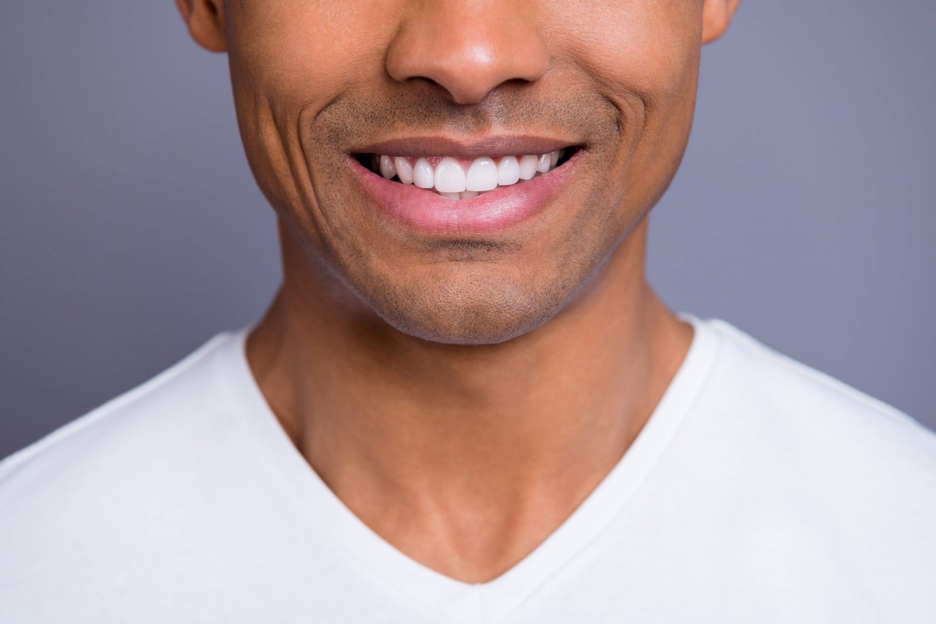 Man without periodontal disease smiling with white teeth.