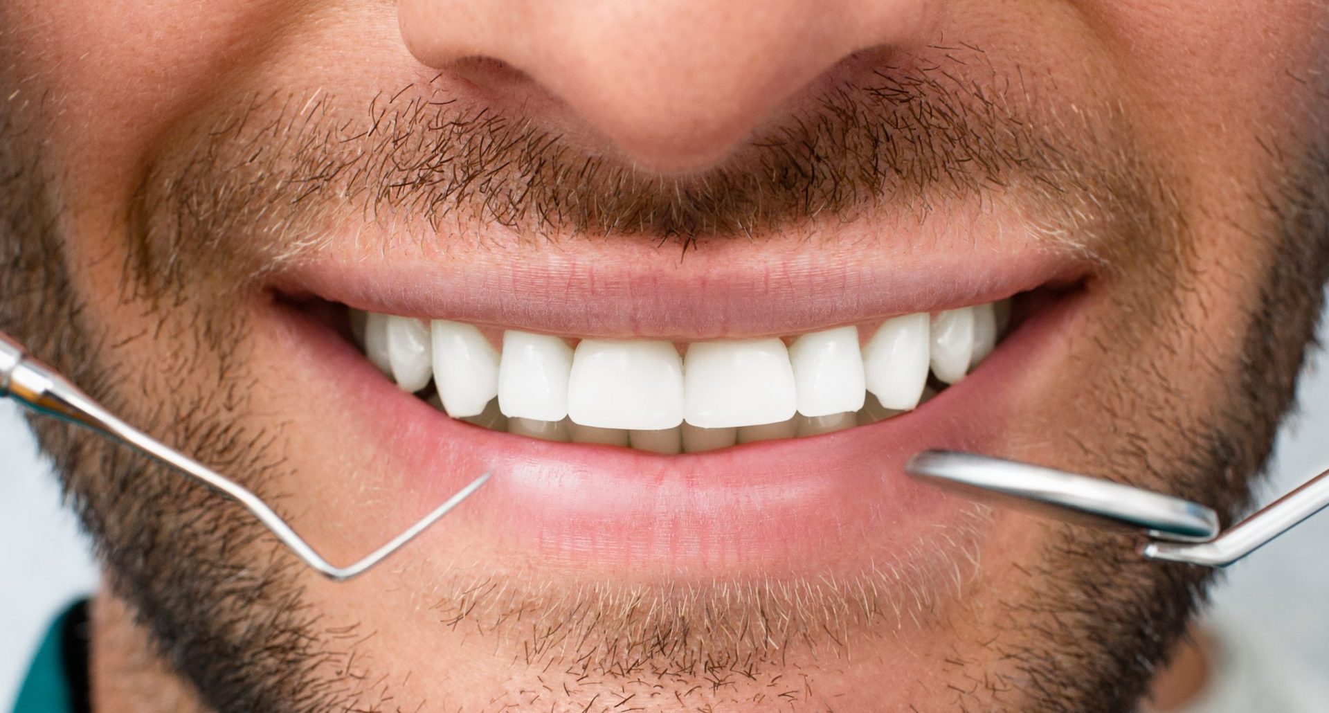 man smiles after periodontal treatment