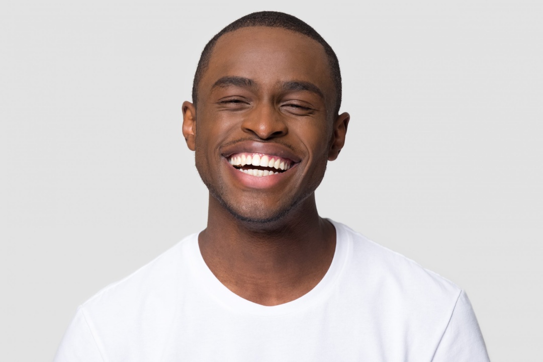 Man smile after gum bleaching