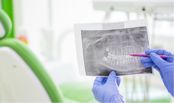 Dentist pointg at X-ray printout