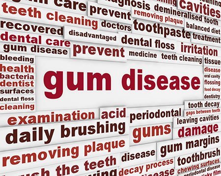 gum disease words