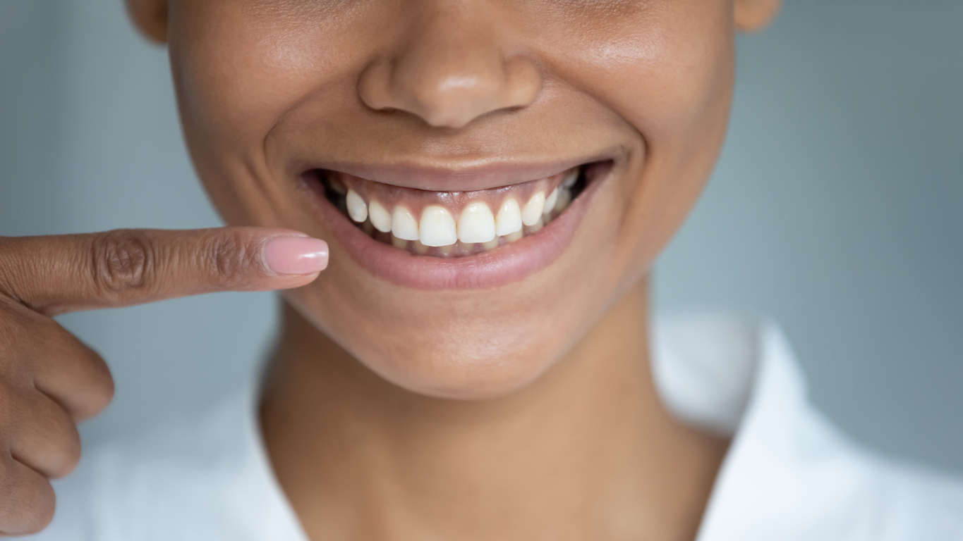 Healthy gums: woman pointing finger at healthy smile